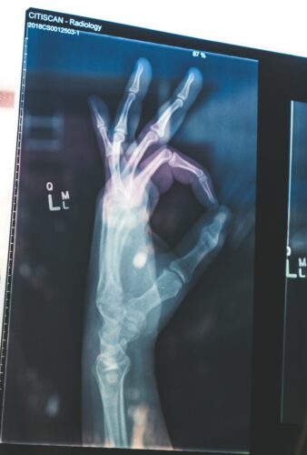 Medical narration: image of x-ray